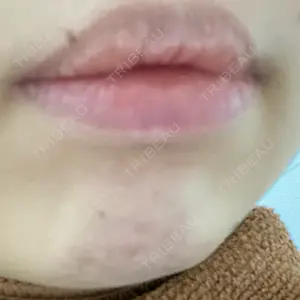 YBC横浜美容外科 YBC横浜美容外科 大宮院口コミ