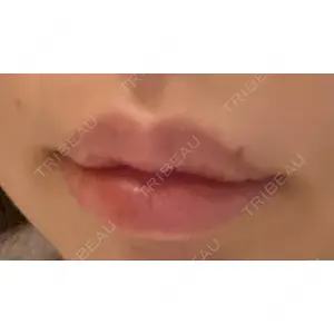 YBC横浜美容外科 YBC横浜美容外科 大宮院口コミ