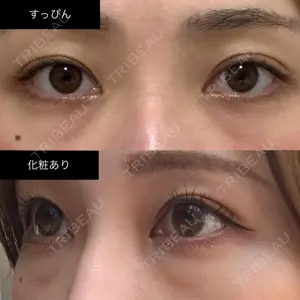 APOLLO BEAUTY CLINIC口コミ