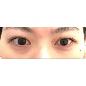 東京イセアクリニック口コミ
