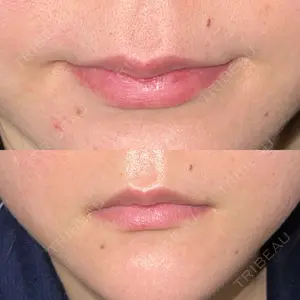 ルラ美容クリニック ルラ美容クリニック 高田馬場院口コミ