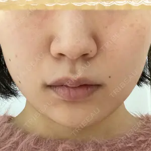 美容皮膚科 Bella Beauty CLINIC大阪心斎橋院口コミ