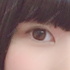 かめい美容クリニック宇都宮口コミ