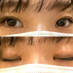口コミ