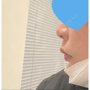 BIANCA CLINIC BIANCA銀座口コミ