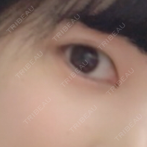 かめい美容クリニック宇都宮口コミ