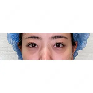 APOLLO BEAUTY CLINIC口コミ