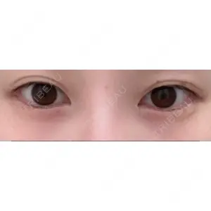 APOLLO BEAUTY CLINIC口コミ