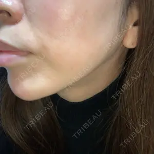 口コミ