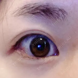 B-LINE CLINIC B-LINE CLINIC 池袋院口コミ