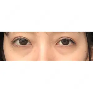 APOLLO BEAUTY CLINIC口コミ