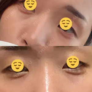 APOLLO BEAUTY CLINIC口コミ