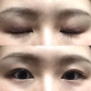 口コミ