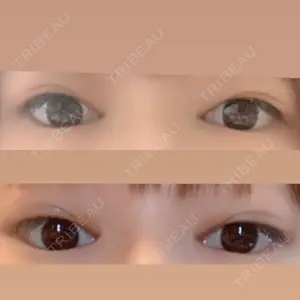 いちのせ形成外科・皮膚科 眼瞼＆フェイスクリニック口コミ