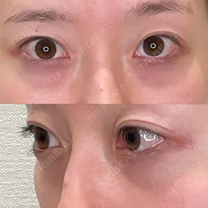 APOLLO BEAUTY CLINIC口コミ