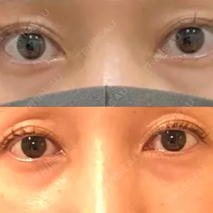 APOLLO BEAUTY CLINIC口コミ