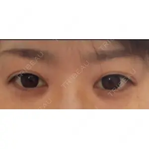 口コミ