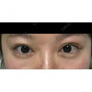 APOLLO BEAUTY CLINIC口コミ