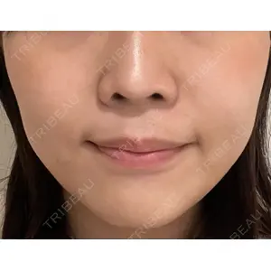 Rinato Beauty Clinic口コミ