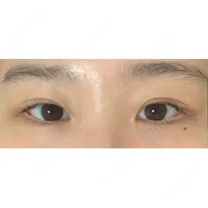 いちのせ形成外科・皮膚科 眼瞼＆フェイスクリニック口コミ