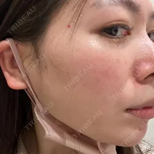 レディアス美容クリニック恵比寿口コミ