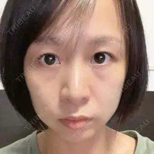 JBCジュノビューティークリニック 新宿三丁目院口コミ