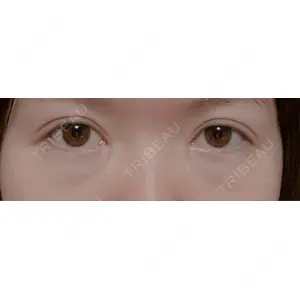 APOLLO BEAUTY CLINIC口コミ