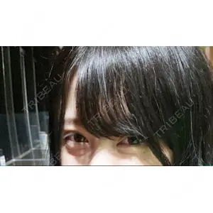 東京イセアクリニック口コミ