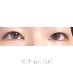 口コミ