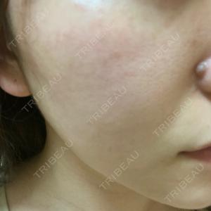 B-LINE CLINIC B-LINE CLINIC 池袋院口コミ