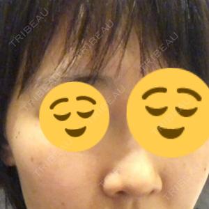B-LINE CLINIC B-LINE CLINIC 池袋院口コミ