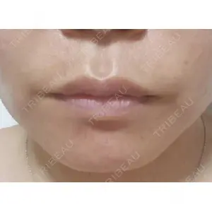 聖心美容クリニック グループ 聖心美容クリニック 広島院口コミ