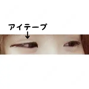 湘南美容クリニック 湘南美容クリニック 宇都宮院口コミ