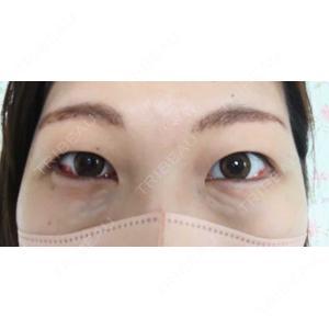 TCB東京中央美容外科 TCB東京中央美容外科 川越院口コミ
