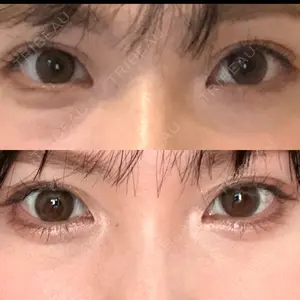 APOLLO BEAUTY CLINIC口コミ