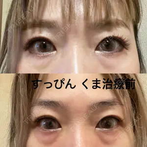口コミ