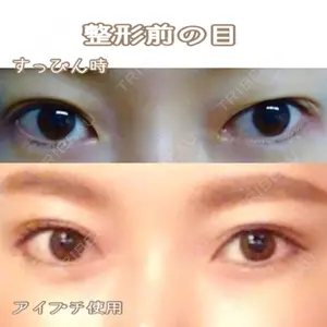 TCB東京中央美容外科 TCB東京中央美容外科 中野院口コミ
