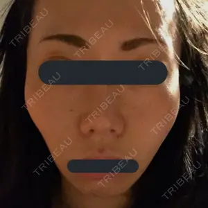 CBK美容外科口コミ