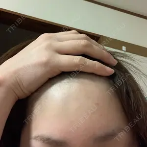 TCB東京中央美容外科 TCB東京中央美容外科 郡山院口コミ