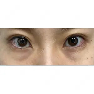 APOLLO BEAUTY CLINIC口コミ