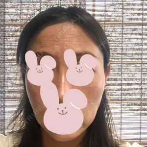 X CLINIC X CLINIC 銀座院口コミ