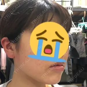 湘南美容クリニック 湘南美容クリニック 名古屋栄院口コミ