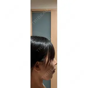 BIANCA CLINIC BIANCA銀座口コミ