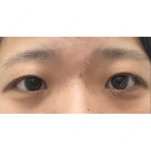 湘南美容クリニック 湘南美容クリニック 池袋東口院口コミ