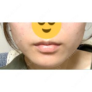 口コミ