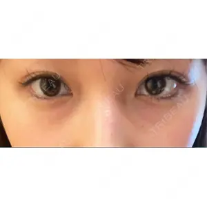 APOLLO BEAUTY CLINIC口コミ