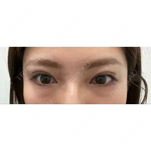 APOLLO BEAUTY CLINIC口コミ