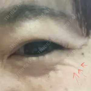 TCB東京中央美容外科 TCB東京中央美容外科 銀座有楽町院口コミ