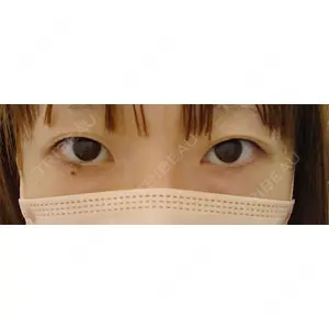 東郷美容形成外科 福岡口コミ