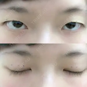口コミ